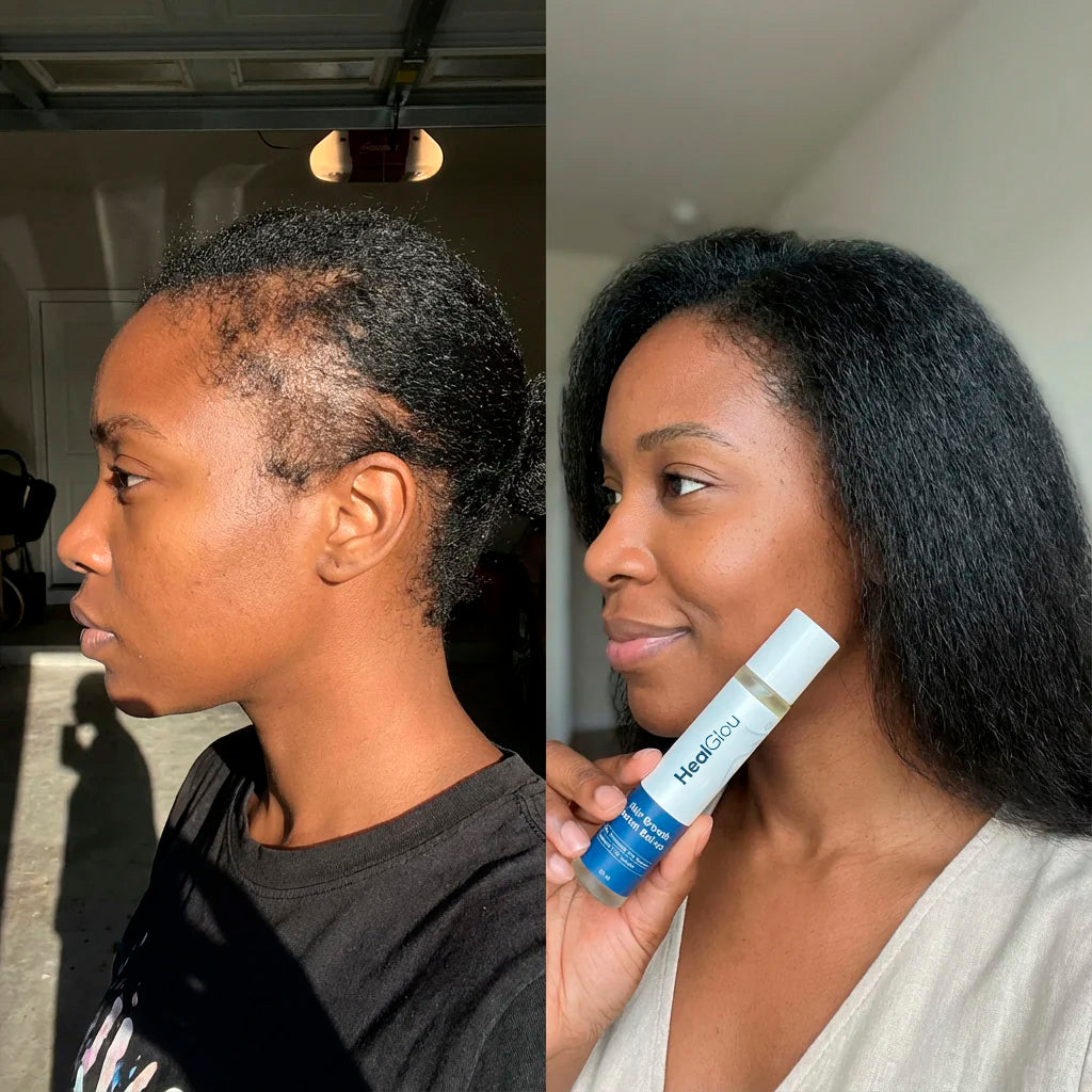 HealGlou HairRevive™ Roll on System